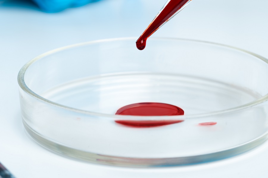 Кровь в стуле