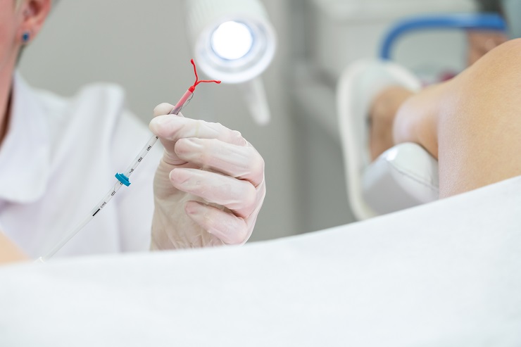 Удаление внутриматочной спирали (сложное) в Южно-Сахалинске