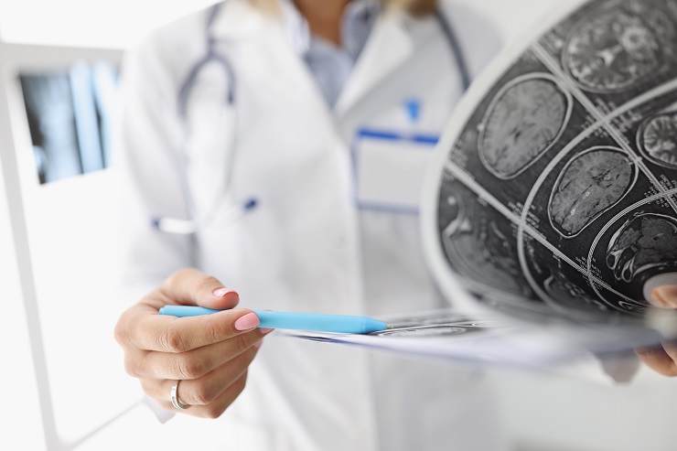 Инсульт: диагностика и помощь жителям Южно-Сахалинска